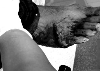 ނިރުބަވެރި ހަމަލާދޭ މީހުންނާ އެކަމަށް ތާއިދުކުރާ މީހުންގެ ތަފާތަކީ ކޮބާ؟